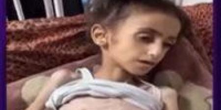 الأمم
      المتحدة:
      1
      من
      كل
      5
      أشخاص
      بغزة
      يواجه
      المجاعة - تكنو بلس