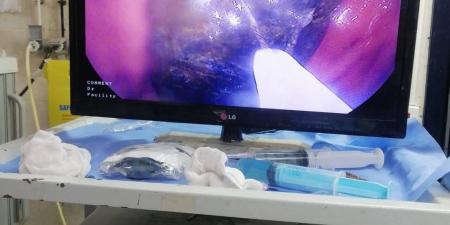 «ابتلعه
      منذ
      عامين»..
      استخراج
      هاتف
      محمول
      من
      معدة
      مريض
      في
      أسيوط - تكنو بلس