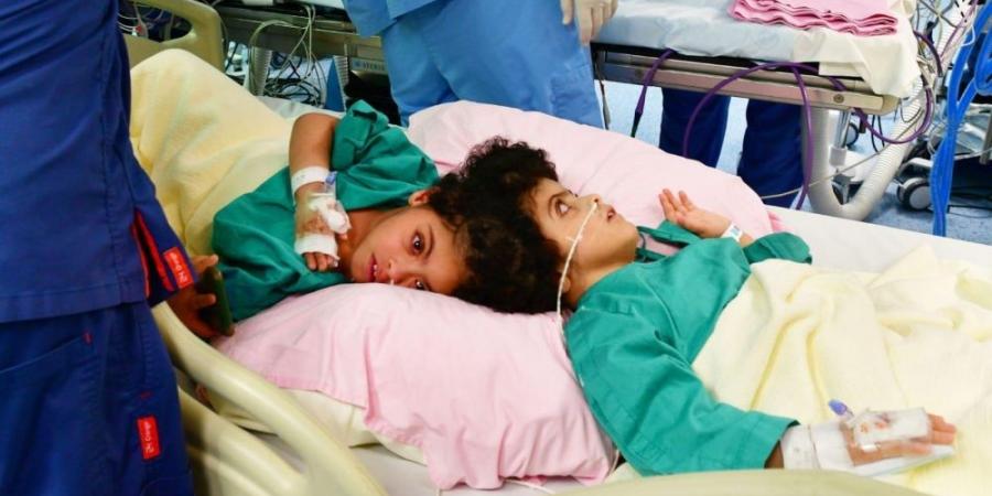 إشادة دولية.. نجاحات كبرى للبرنامج السعودي لفصل التوائم الملتصقة - تكنو بلس