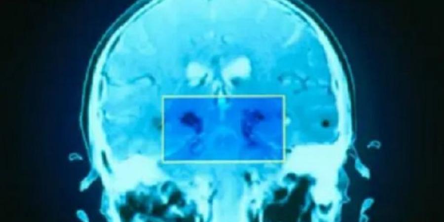 6
حيل
تعالج
الضغط
العصبي
والقلق
ومشاكل
المخ - تكنو بلس