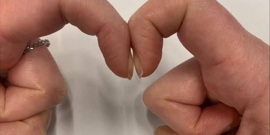علامة
تحذيرية
على
أطراف
الأصابع
تُنذر
بالسرطان..
اكتشفيها
قبل
فوات
الأوان - تكنو بلس