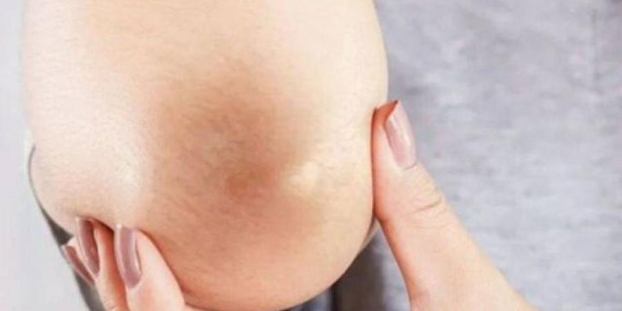 مكونات لا تخطر ببالك تحيي ركبتيك وأكواعك - تكنو بلس